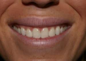 1764208711_thumb_Kelsey-Before_1024-300x214-1