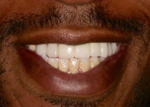 thumb_tony_after_1024-300x214-1