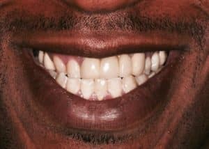 thumb_tony_before_1024-300x214-1